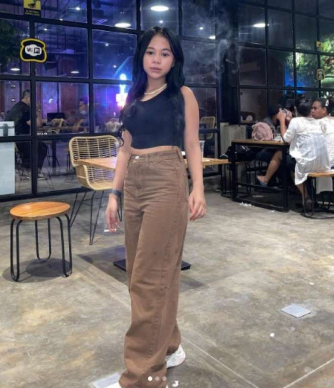 7 Perawatan Kecantikan Cimoy Montok, Filler Hidung Sampai Suntik Salmon DNA!