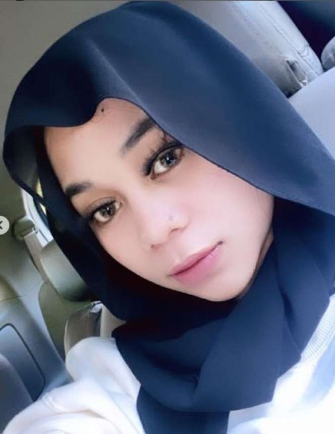 7 Perawatan Kecantikan Cimoy Montok, Filler Hidung Sampai Suntik Salmon DNA!