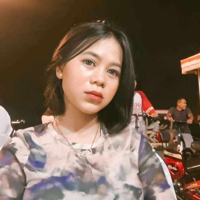 7 Perawatan Kecantikan Cimoy Montok, Filler Hidung Sampai Suntik Salmon DNA!