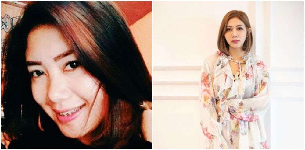 8 Potret Dulu Vs Kini Delta Hesti ‘Crazy Rich Surabaya’, Foto Jadulnya Bikin Pangling!
