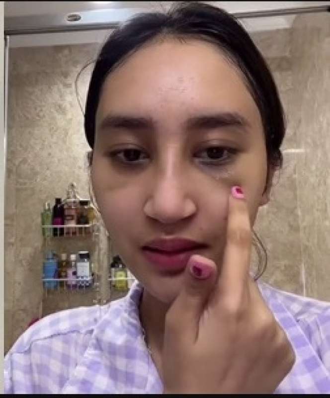 7 Potret Permesta Dhyaz Anak Farida Nurhan Usai Oplas Hidung, Parasnya Bikin Salfok!