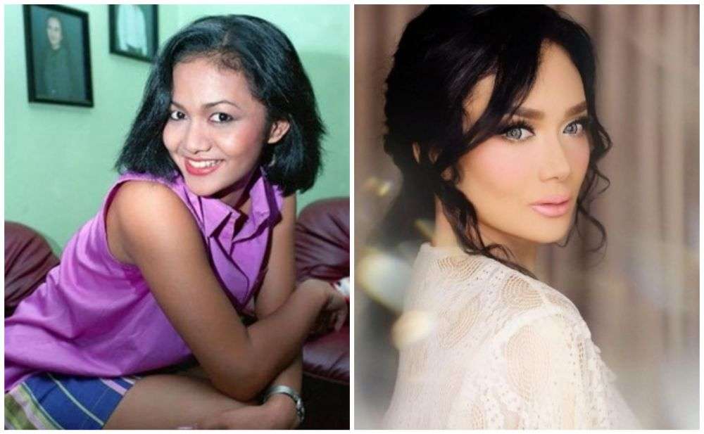 12 Potret Artis Sebelum Vs Sesudah Lakukan Filler Wajah, Cimoy Montok Jadi Beda Banget!