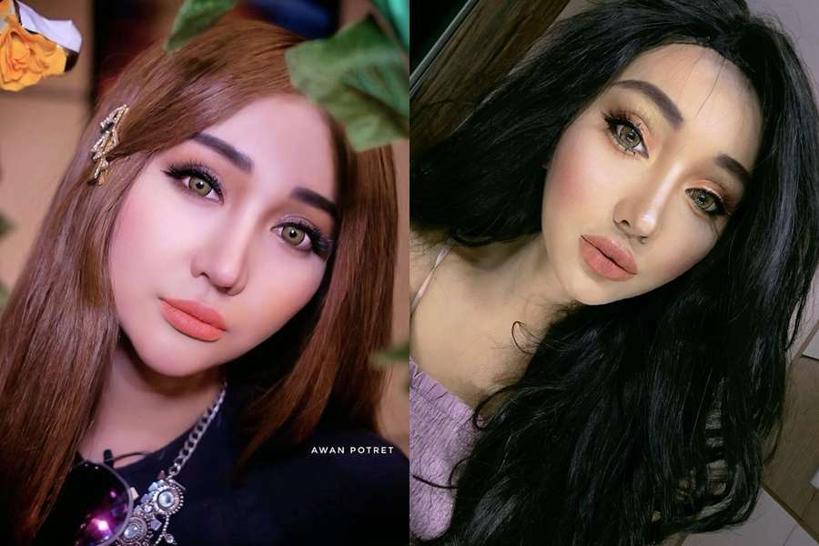 12 Potret Artis Sebelum Vs Sesudah Lakukan Filler Wajah, Cimoy Montok Jadi Beda Banget!
