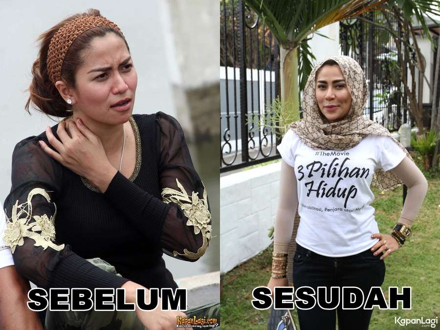 12 Potret Artis Sebelum Vs Sesudah Lakukan Filler Wajah, Cimoy Montok Jadi Beda Banget!