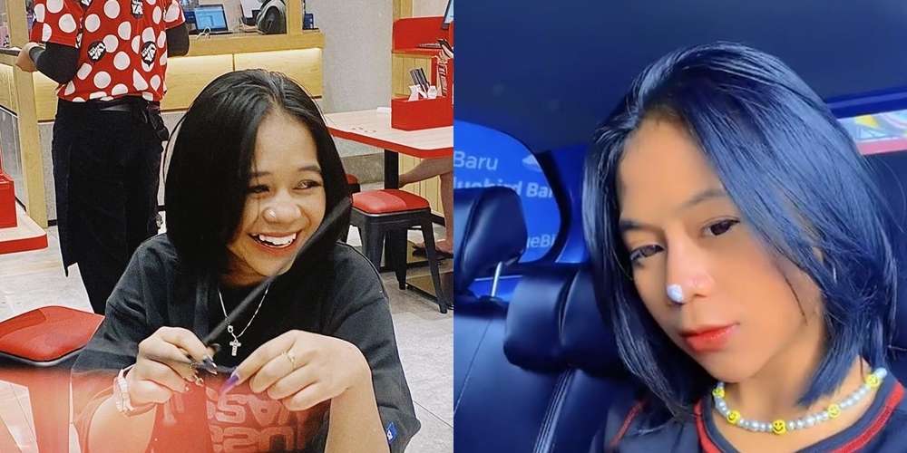 12 Potret Artis Sebelum Vs Sesudah Lakukan Filler Wajah, Cimoy Montok Jadi Beda Banget!