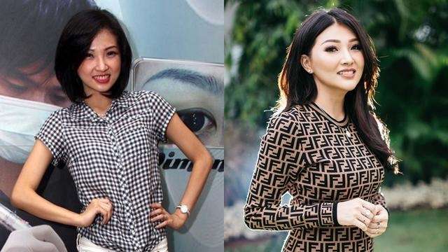 12 Potret Artis Sebelum Vs Sesudah Lakukan Filler Wajah, Cimoy Montok Jadi Beda Banget!