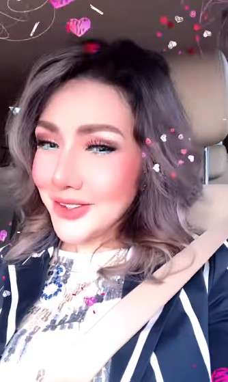 10 Potret Terbaru Barbie Kumalasari Usai Operasi Hidung Rp50 Juta, Berubah Drastis Makin Cantik!