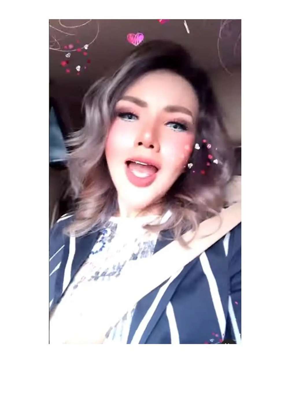 10 Potret Terbaru Barbie Kumalasari Usai Operasi Hidung Rp50 Juta, Berubah Drastis Makin Cantik!