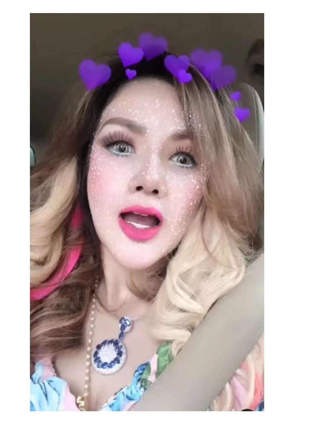 10 Potret Terbaru Barbie Kumalasari Usai Operasi Hidung Rp50 Juta, Berubah Drastis Makin Cantik!