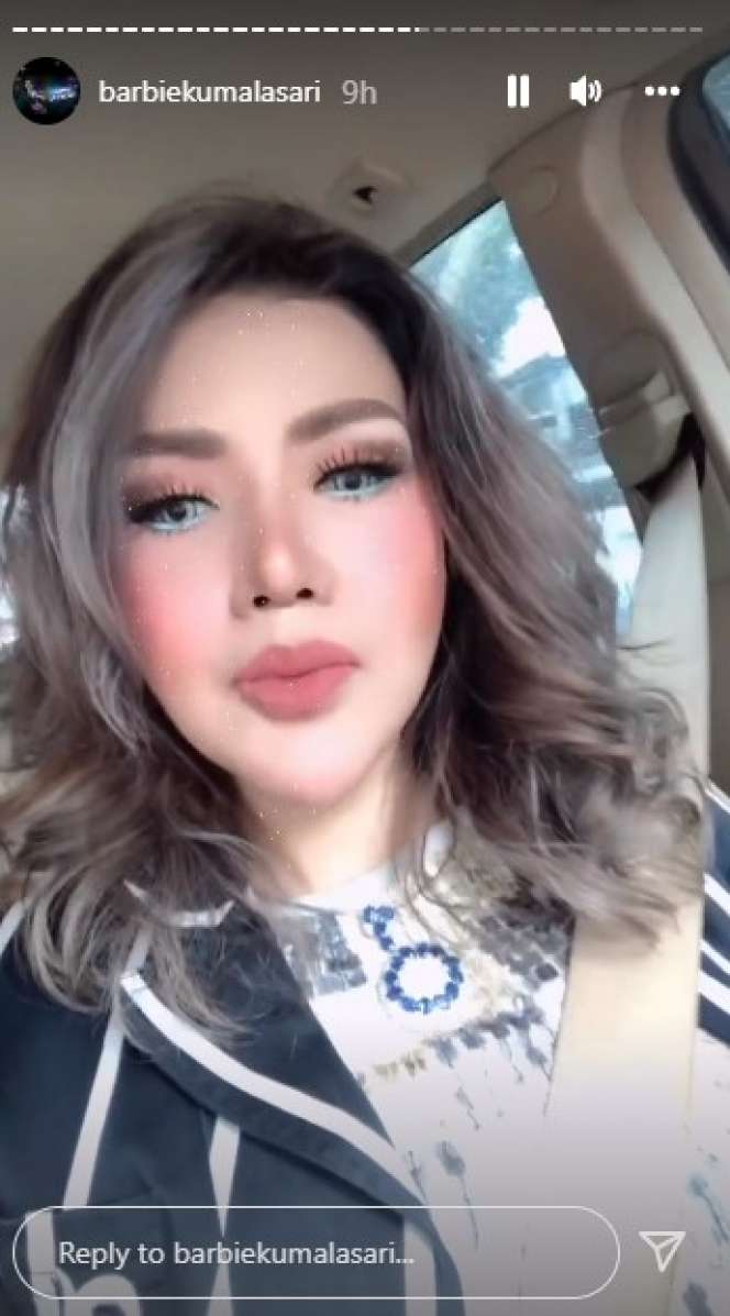 10 Potret Terbaru Barbie Kumalasari Usai Operasi Hidung Rp50 Juta, Berubah Drastis Makin Cantik!