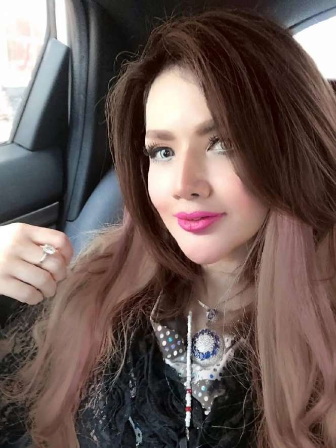 10 Potret Terbaru Barbie Kumalasari Usai Operasi Hidung Rp50 Juta, Berubah Drastis Makin Cantik!