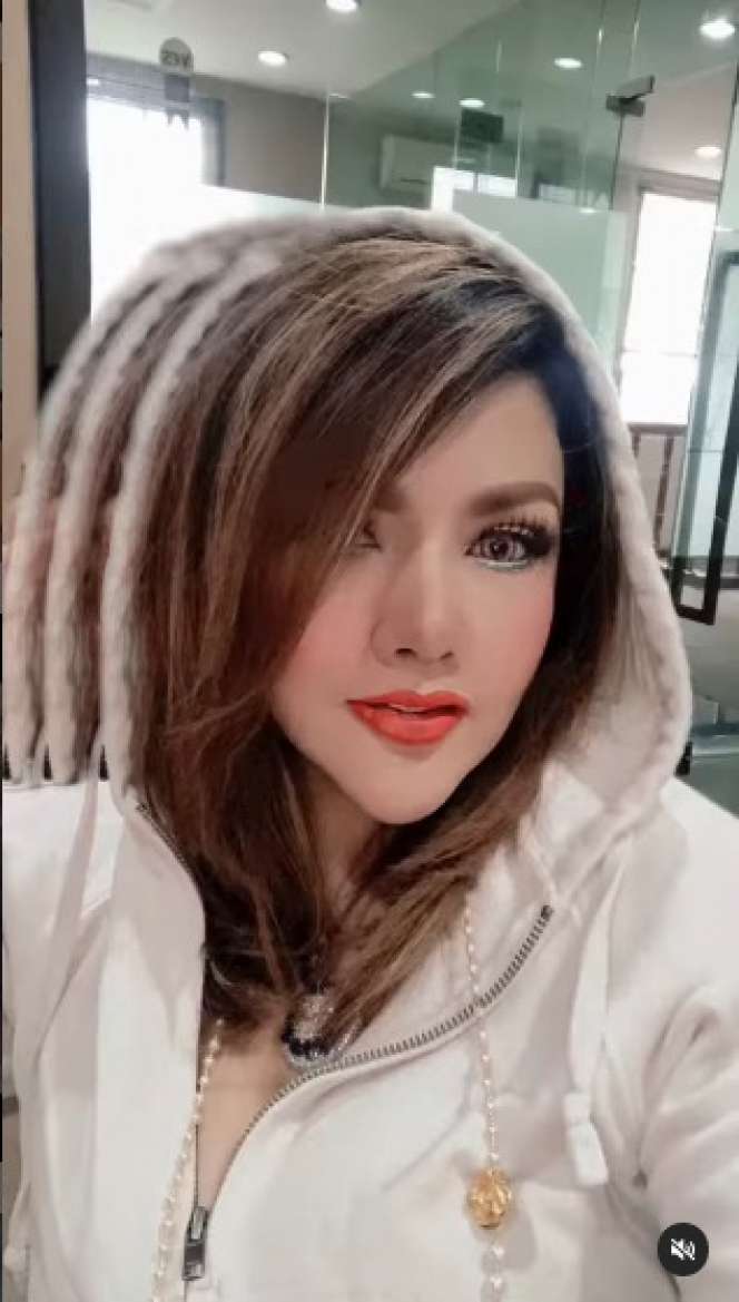 10 Potret Terbaru Barbie Kumalasari Usai Operasi Hidung Rp50 Juta, Berubah Drastis Makin Cantik!