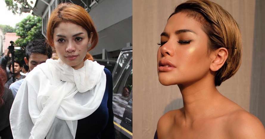 Potret 10 Seleb Usai Operasi Hidung, Ada yang Alami Implan Jebol Hingga Bernanah!