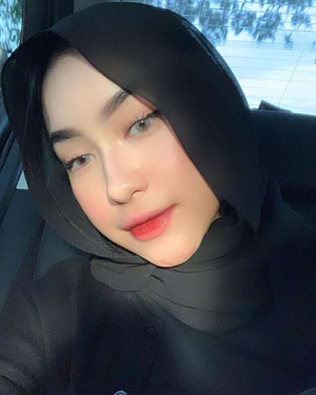 7 Potret Ratna Kaidah Putri Bungsu Adi Bing Slamet yang Jarang Tersorot, Paras Cantiknya Bikin Kagum!