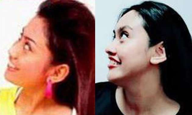 12 Potret Dulu Vs Kini Jebolan AFI, Mawar Dhimas Beda Banget, Bikin Pangling!