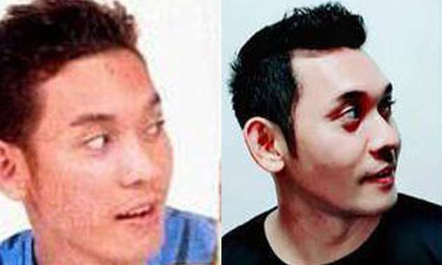 12 Potret Dulu Vs Kini Jebolan AFI, Mawar Dhimas Beda Banget, Bikin Pangling!