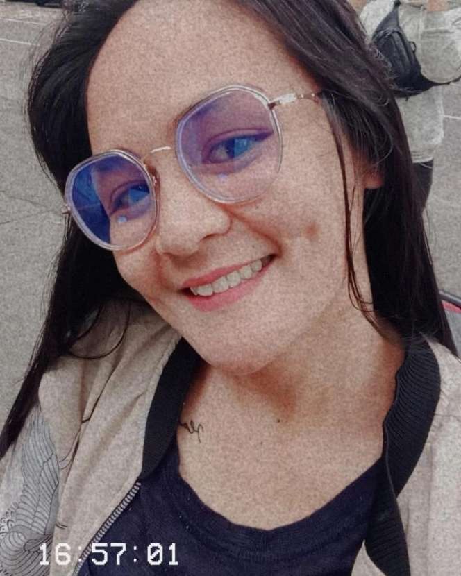 8 Potret Chaca Mantan Istri Andika Kangen Band Usai Rehabilitasi Narkoba, Wajahnya Berubah Drastis!