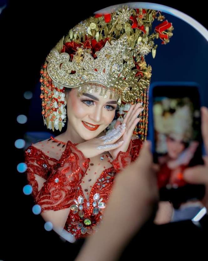 8 Potret Chaca Mantan Istri Andika Kangen Band Usai Rehabilitasi Narkoba, Wajahnya Berubah Drastis!