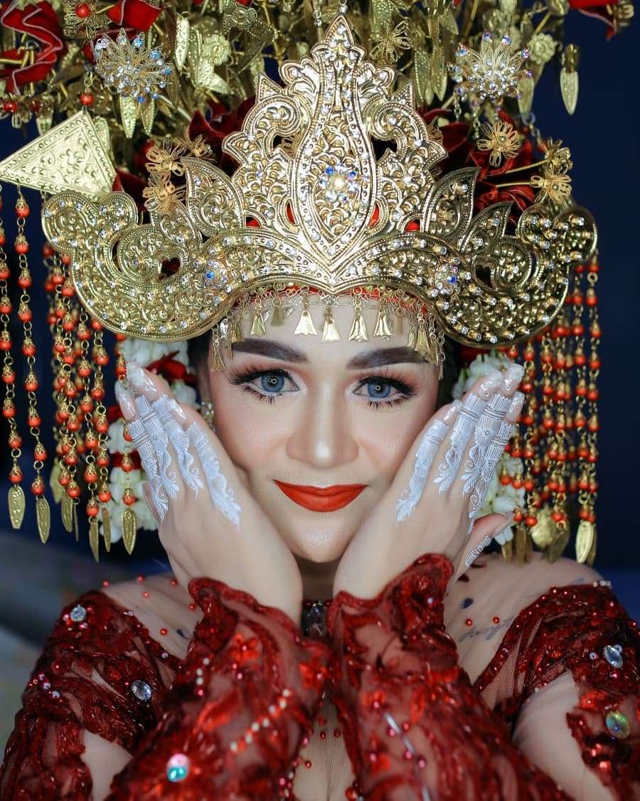 8 Potret Chaca Mantan Istri Andika Kangen Band Usai Rehabilitasi Narkoba, Wajahnya Berubah Drastis!
