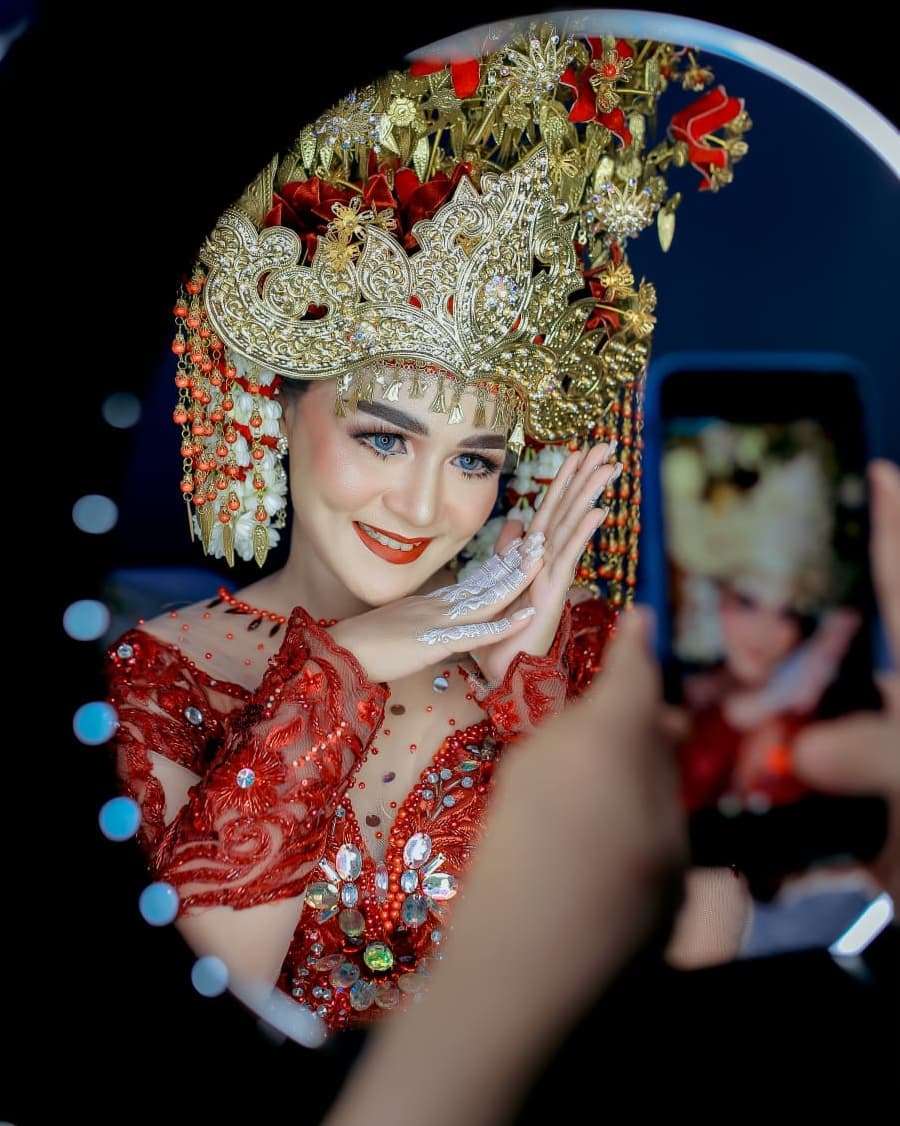 8 Potret Chaca Mantan Istri Andika Kangen Band Usai Rehabilitasi Narkoba, Wajahnya Berubah Drastis!