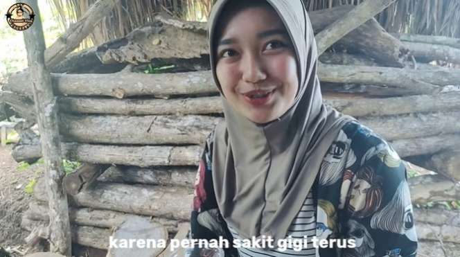 8 Potret Gadis Desa yang Cantiknya Bak Bidadari, Rela Bongkar Celengan Demi Pasang Behel Gigi!