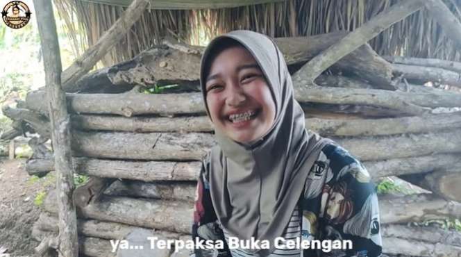 8 Potret Gadis Desa yang Cantiknya Bak Bidadari, Rela Bongkar Celengan Demi Pasang Behel Gigi!