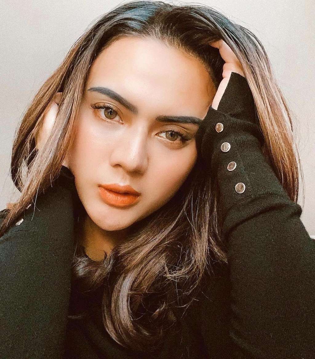 Ingat Model Cantik yang Dulu Disebut 'Layani' Gembong Narkoba? Kini Kondisi Wajahnya Memprihatinkan, Lihat 9 Potretnya