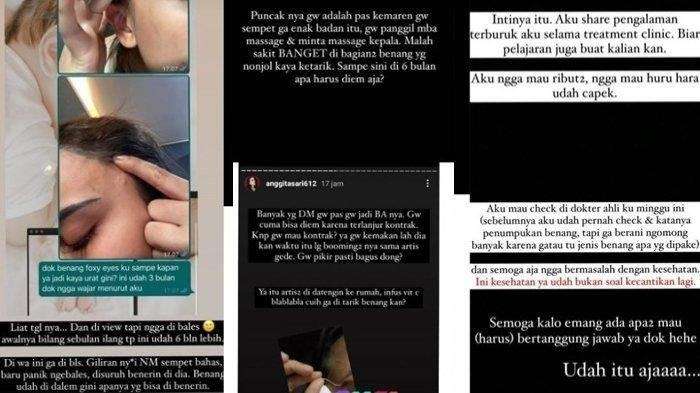 Ingat Model Cantik yang Dulu Disebut 'Layani' Gembong Narkoba? Kini Kondisi Wajahnya Memprihatinkan, Lihat 9 Potretnya
