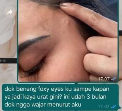 Ingat Model Cantik yang Dulu Disebut 'Layani' Gembong Narkoba? Kini Kondisi Wajahnya Memprihatinkan, Lihat 9 Potretnya