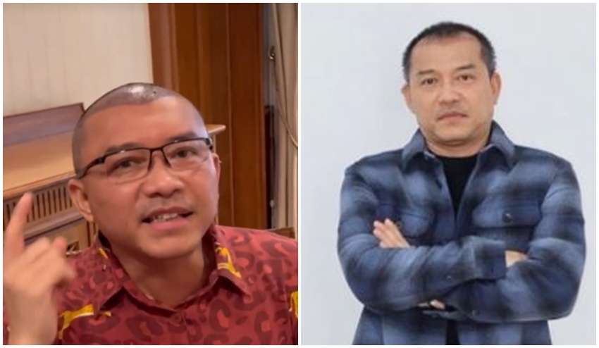 8 Potret Sebelum dan Sesudah Anang Hermansyah Lakukan Transplantasi Rambut, Terlihat Lebih Muda!