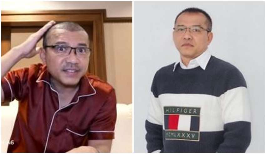 8 Potret Sebelum dan Sesudah Anang Hermansyah Lakukan Transplantasi Rambut, Terlihat Lebih Muda!