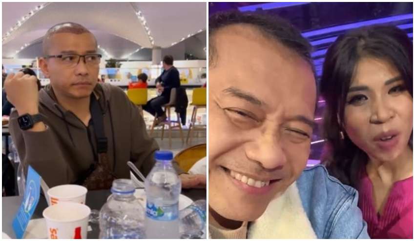 8 Potret Sebelum dan Sesudah Anang Hermansyah Lakukan Transplantasi Rambut, Terlihat Lebih Muda!