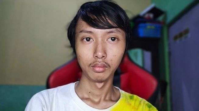 8 Potret Kabar Ghozali Everyday ‘Miliarder NFT’, Kini Nasibnya Berubah Drastis Usai Tak Viral