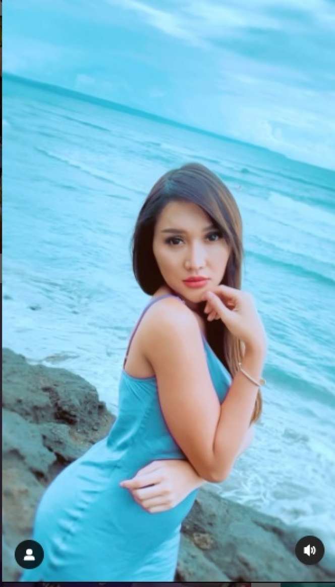 Potret Transformasi Lucinta Luna Sebelum vs Sesudah Operasi Ganti Kepala, Hasilnya Beda Banget!