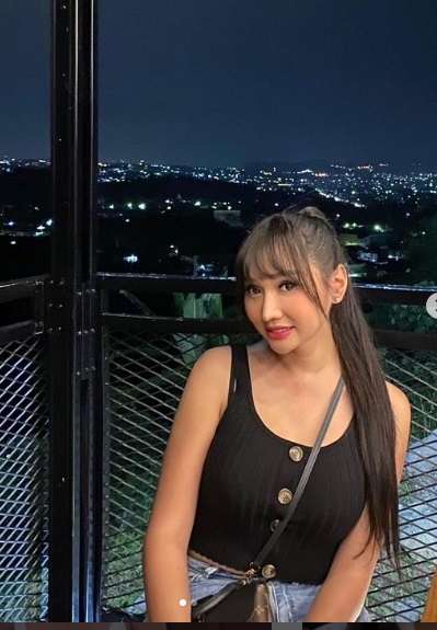 Potret Transformasi Lucinta Luna Sebelum vs Sesudah Operasi Ganti Kepala, Hasilnya Beda Banget!
