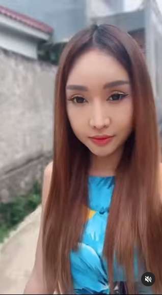 Potret Transformasi Lucinta Luna Sebelum vs Sesudah Operasi Ganti Kepala, Hasilnya Beda Banget!