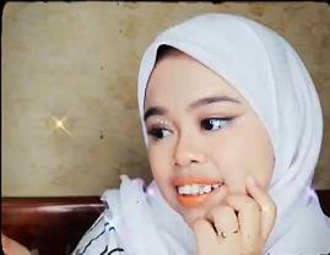 5 Potret Terbaru Kekeyi Usai Filler Hidung, Bikin Terkejut!