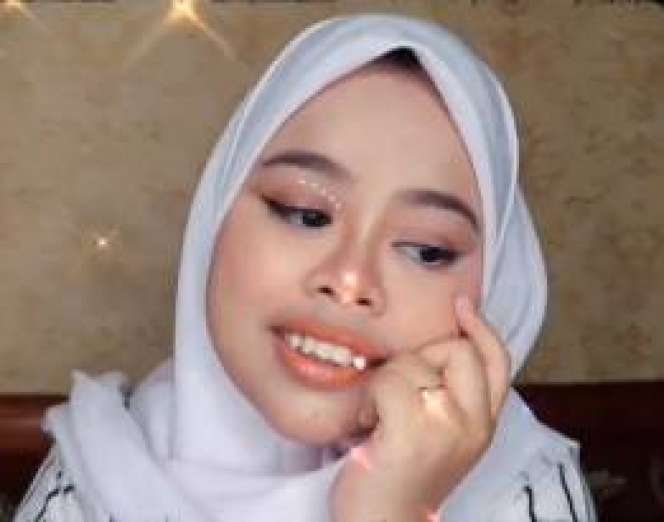 5 Potret Terbaru Kekeyi Usai Filler Hidung, Bikin Terkejut!