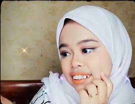 5 Potret Terbaru Kekeyi Usai Filler Hidung, Bikin Terkejut!