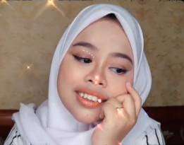 5 Potret Terbaru Kekeyi Usai Filler Hidung, Bikin Terkejut!