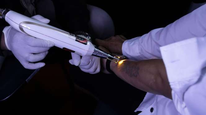 FOTO: Roadshow Hapus Tato Gratis Untuk Semua Kalangan di Jakarta 