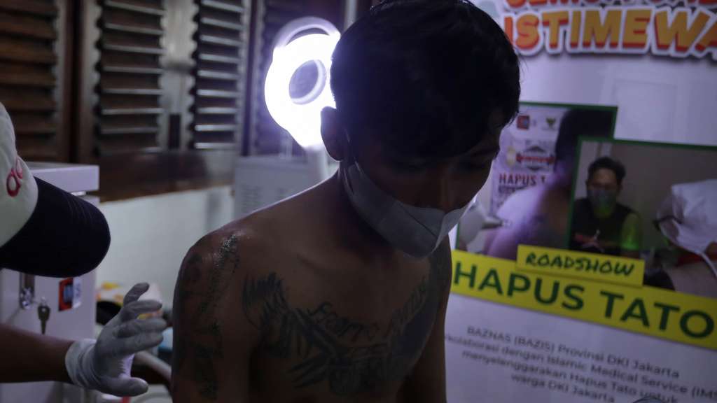 FOTO: Roadshow Hapus Tato Gratis Untuk Semua Kalangan di Jakarta 