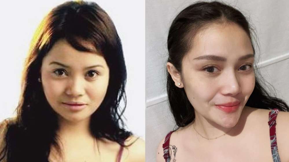 9 Potret Artis Sebelum VS Sesudah Oplas Hidung, Seleb Terakhir Disebut Aneh & Banjir Hujatan!