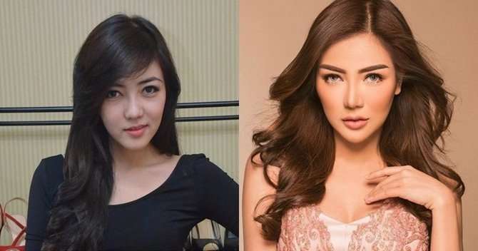 9 Potret Artis Sebelum VS Sesudah Oplas Hidung, Seleb Terakhir Disebut Aneh & Banjir Hujatan!