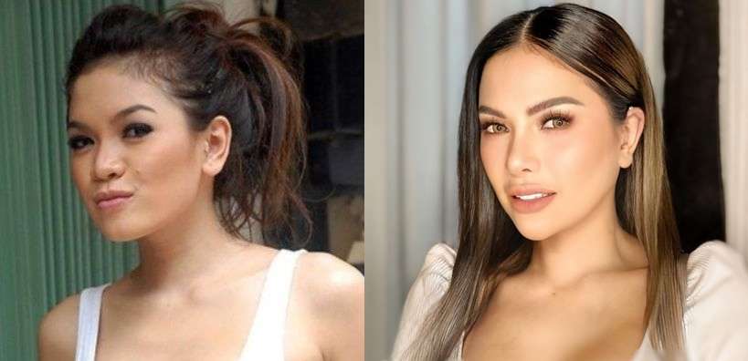 9 Potret Artis Sebelum VS Sesudah Oplas Hidung, Seleb Terakhir Disebut Aneh & Banjir Hujatan!