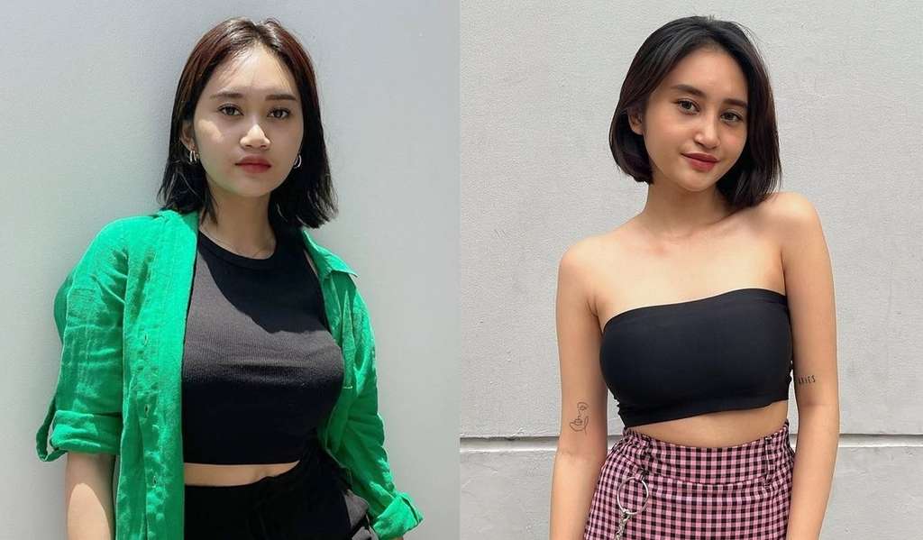 9 Potret Artis Sebelum VS Sesudah Oplas Hidung, Seleb Terakhir Disebut Aneh & Banjir Hujatan!