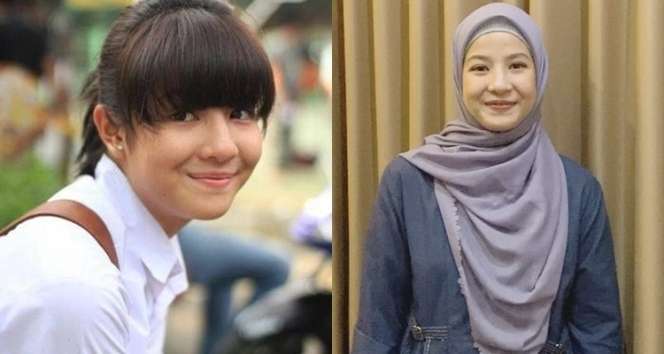 Potret Dulu VS Kini 7 Model yang Menikah Dengan Anak Band, Bikin Pangling!