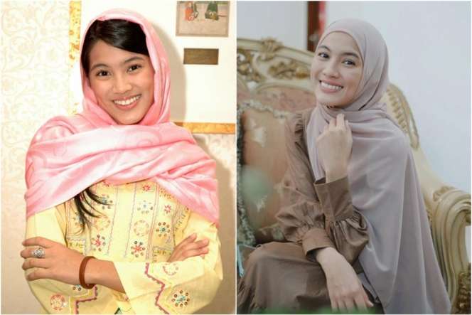 Disebut Makin Kurus, Inilah Potret Dulu dan Kini Alyssa Soebandono, Pipi Tirusnya Jadi Sorotan!