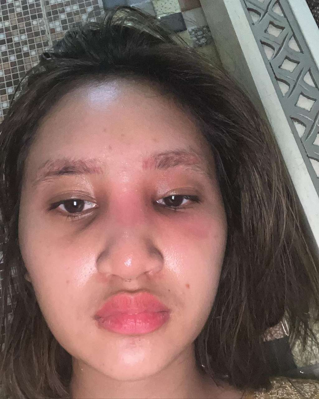 5 Potret Permesta Dhyaz Anak Farida Nurhan Alami Infeksi Hidung Pasca Oplas