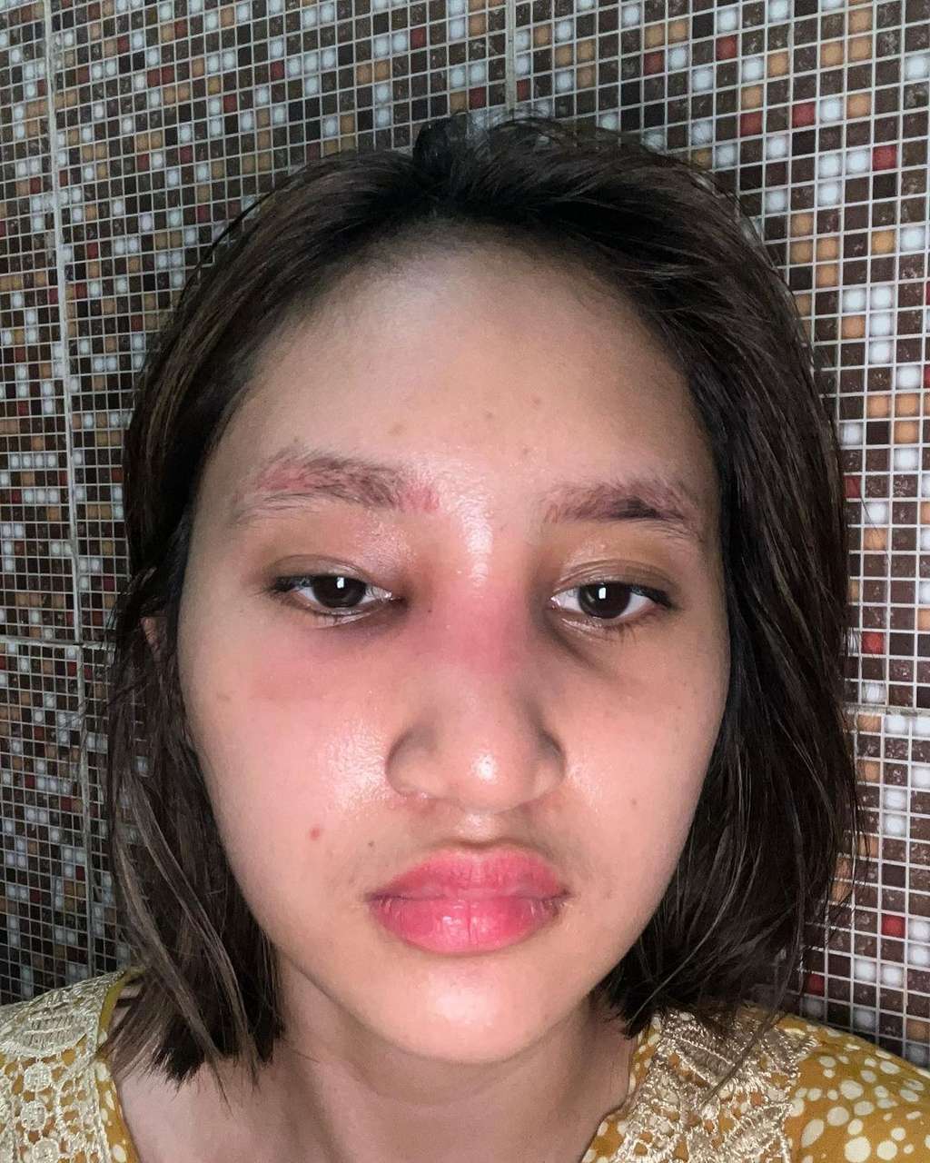 5 Potret Permesta Dhyaz Anak Farida Nurhan Alami Infeksi Hidung Pasca Oplas